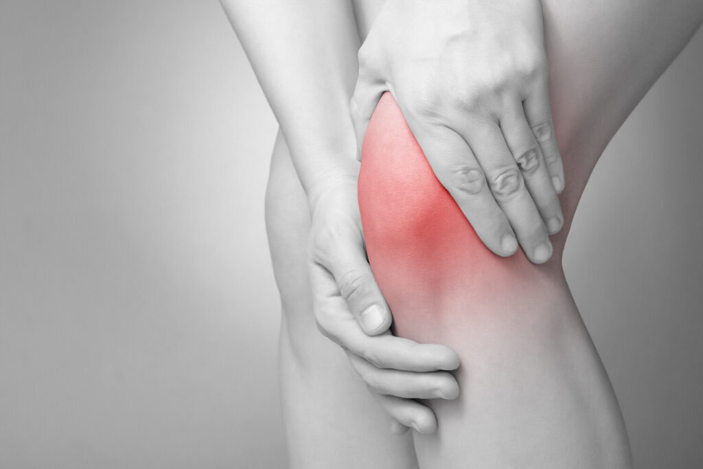 Black and white photo of person holding her knee with pain. The knee is painful and inflammed.