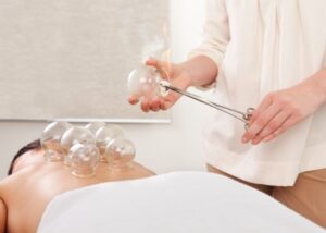 An acupuncturst providing a female patient with fire cupping on her mid and lower back. Fire cupping is used to help reduce muscle tension and help release toxins.