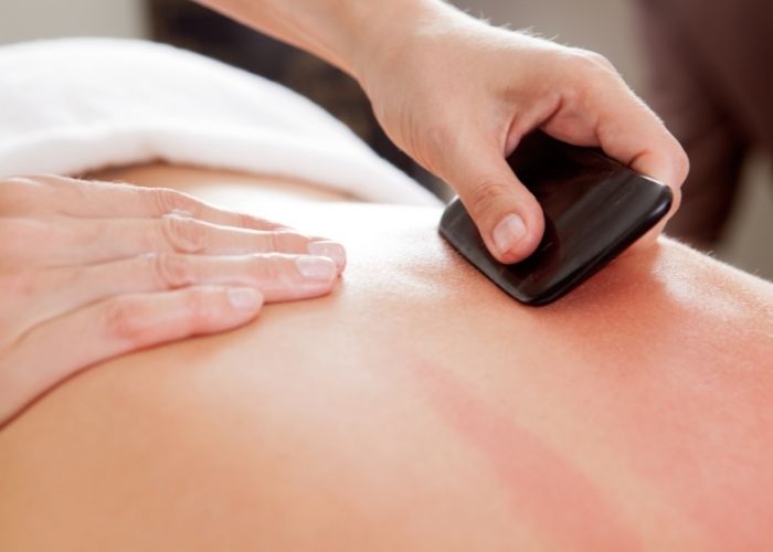 An acupunturist providing a gua sha massage to a patients lower back to help reduce pain.